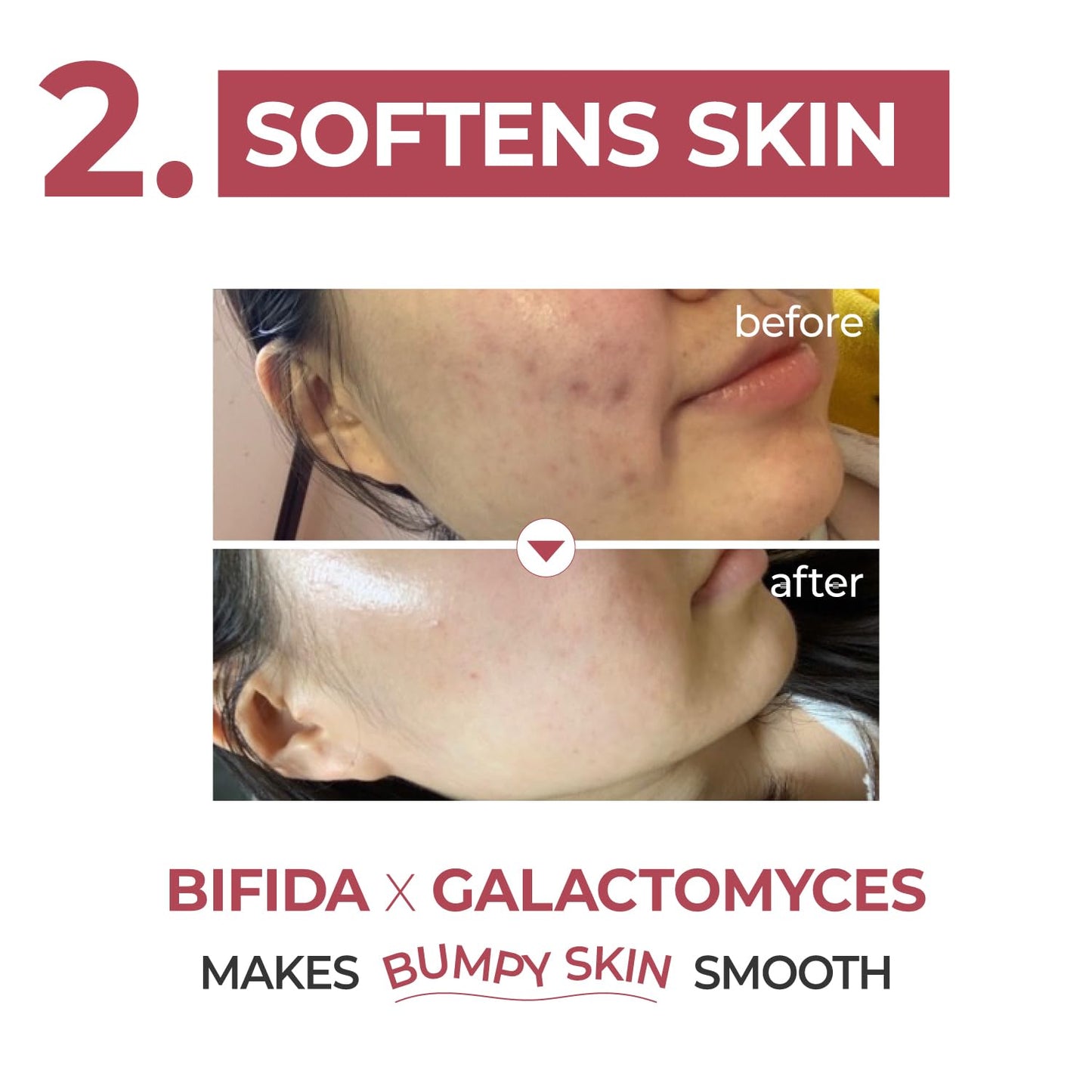 numbuzin - No. 3 Skin Softening Serum