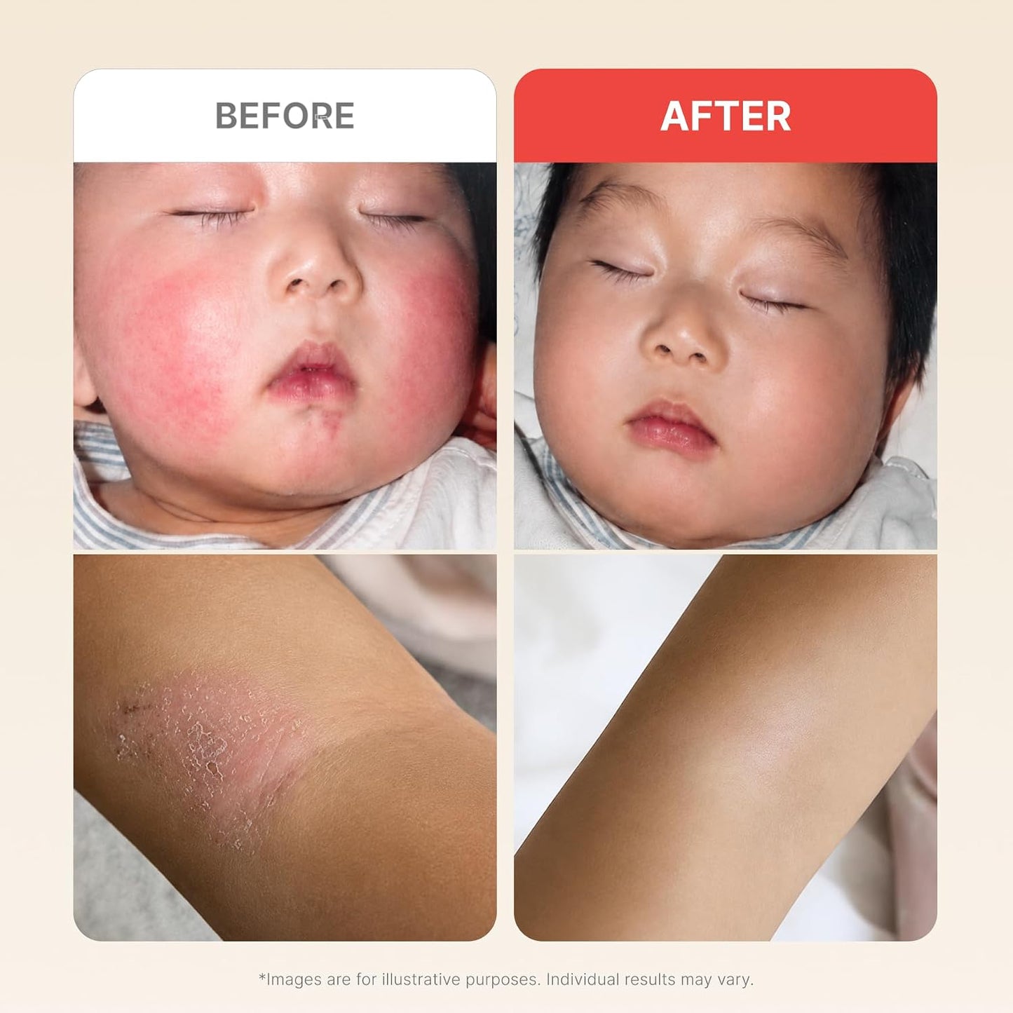 ATOPALM MLE Eczema Cream, 2.2 fl oz (65ml)