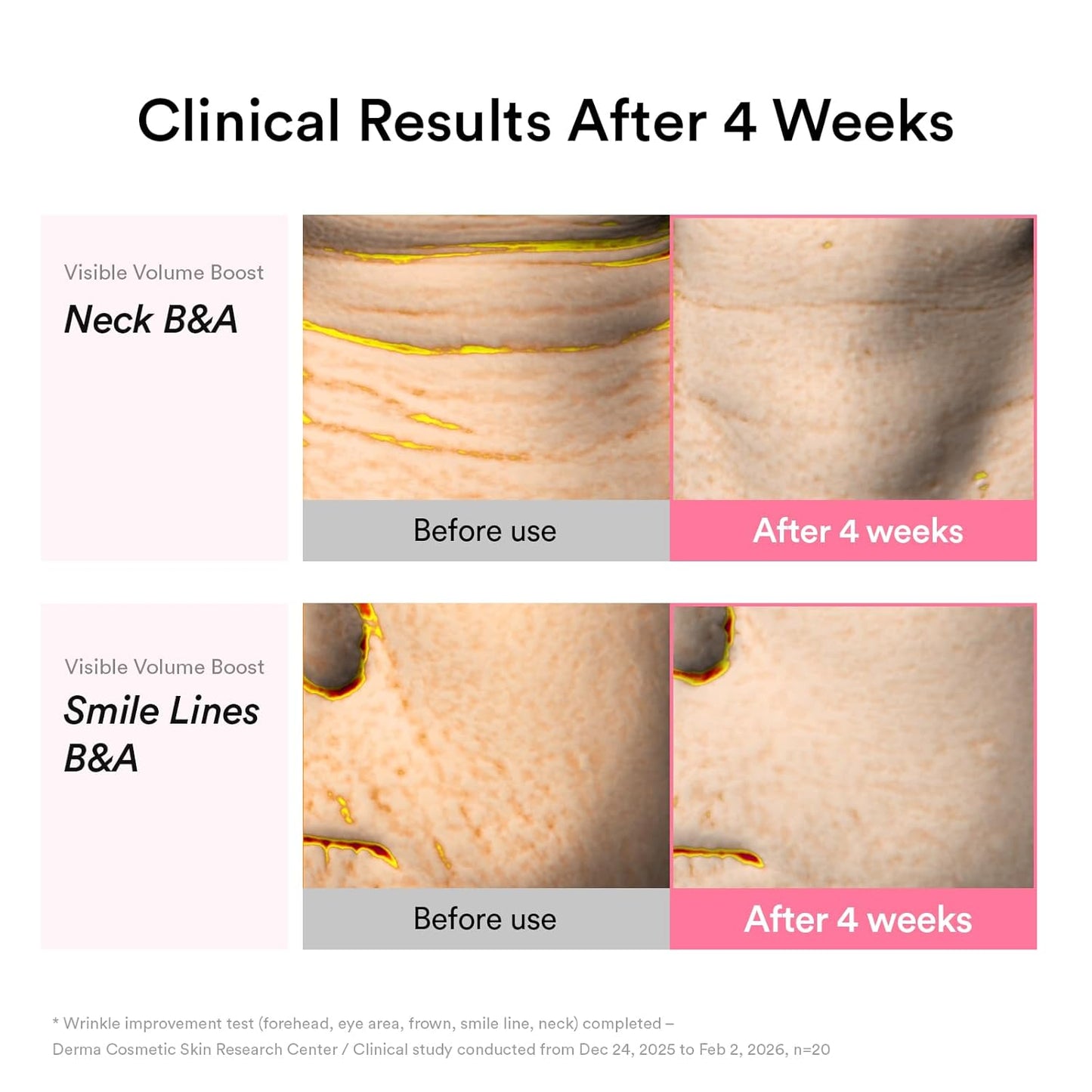 Abib PDRN Volume fill-it Booster Cream 2.5 tube